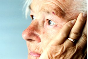 Maladie d'alzheimer